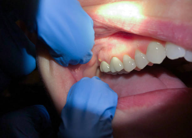 Best Emergency Dental Care for Broken or Chipped Teeth in Flowing Wells, AZ